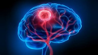 brain